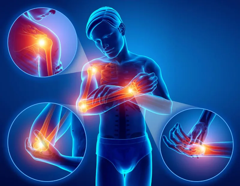 Dores Articulares e Musculoesqueléticas